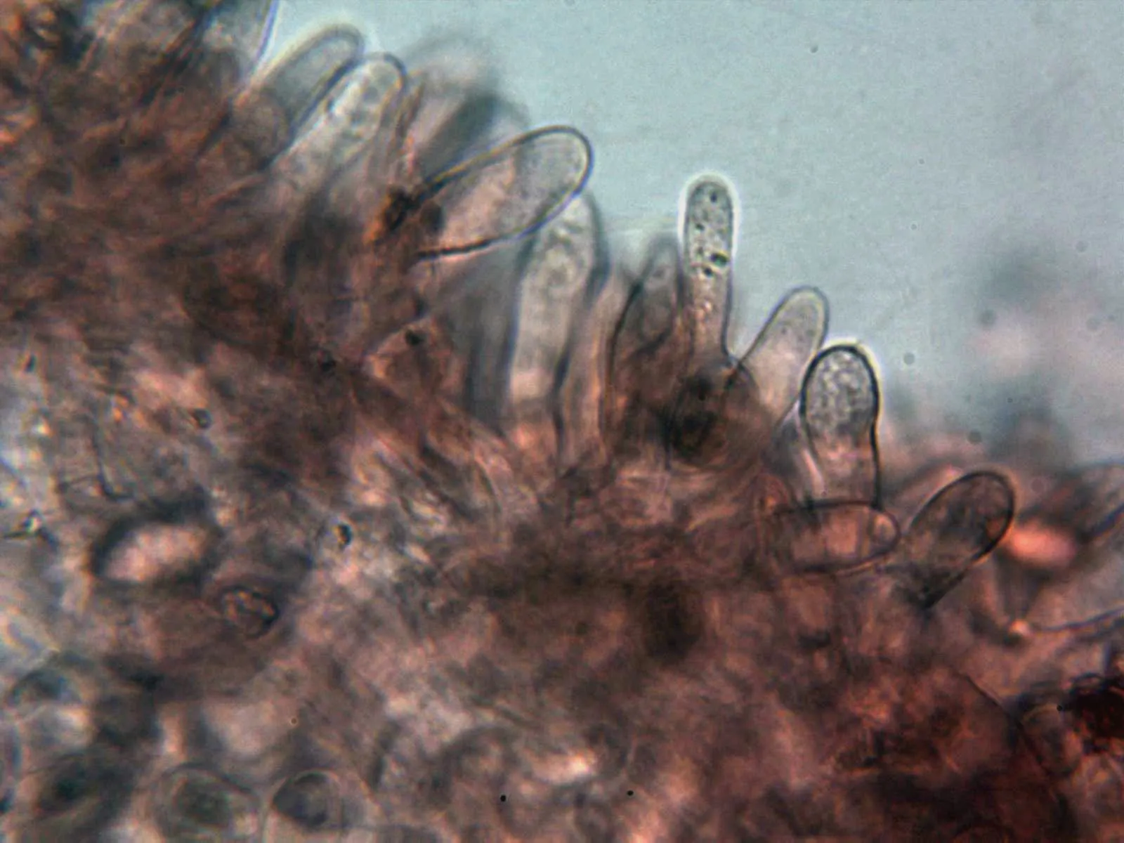 Microscopía de Macrolepiota mastoidea - 11 - Queilocistidios 3